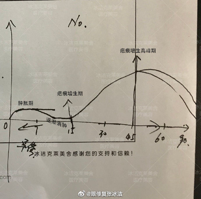 内眼角增生疤痕恢复历程
