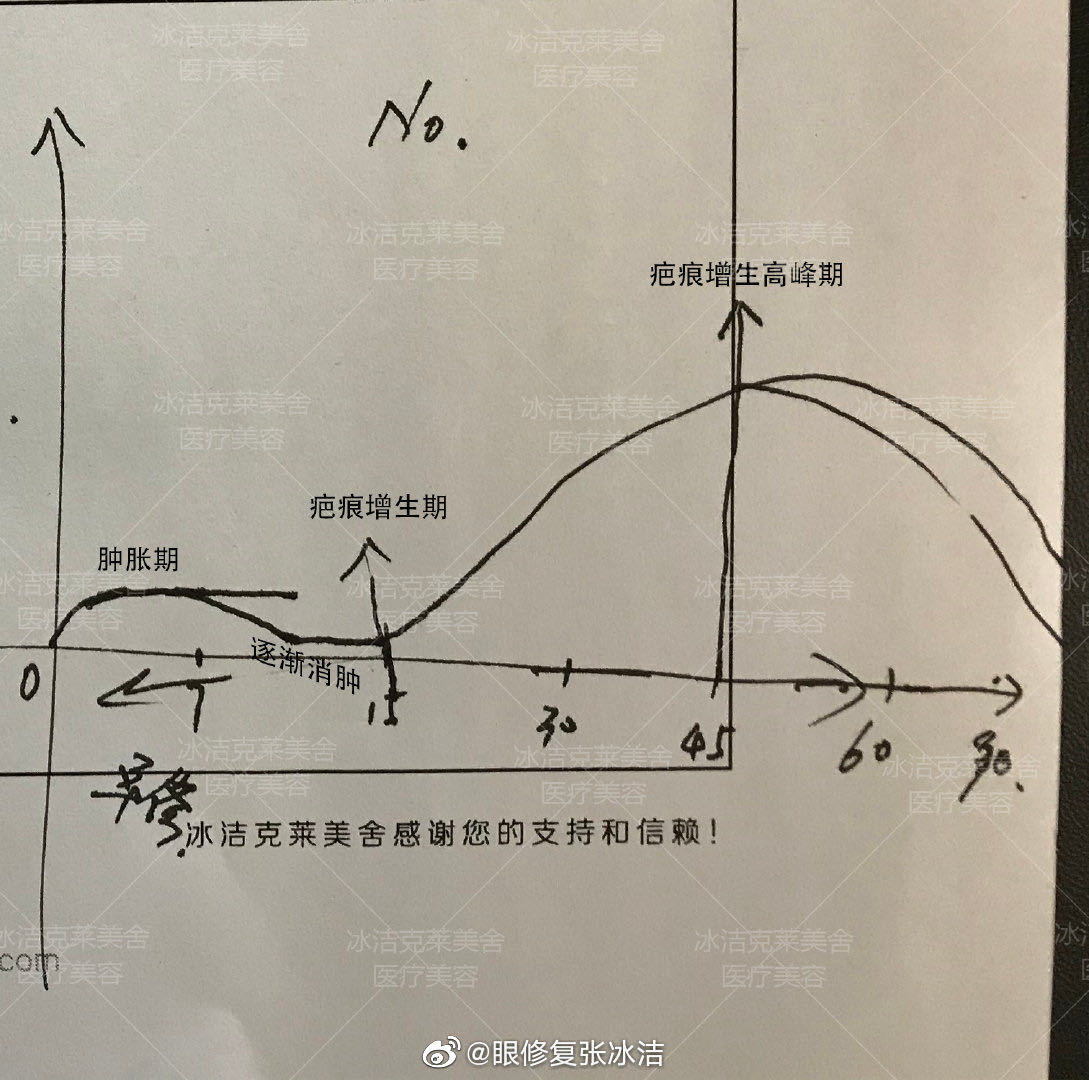 内眼角疤痕增生恢复示例图